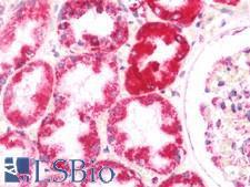SKIV2L / SKI2 Antibody - Human Kidney: Formalin-Fixed, Paraffin-Embedded (FFPE)