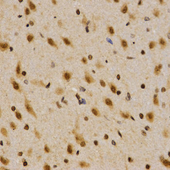 SKIV2L2 Antibody - Immunohistochemistry of paraffin-embedded rat brain tissue using MTR4 antibody at dilution of 1:200 (x400 lens).