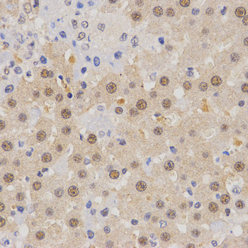 SKIV2L2 Antibody - Immunohistochemistry of paraffin-embedded rat liver tissue using MTR4 antibody at dilution of 1:200 (x400 lens).
