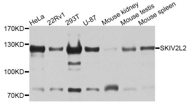 SKIV2L2 Antibody - Western blot analysis of extracts of various cell lines.