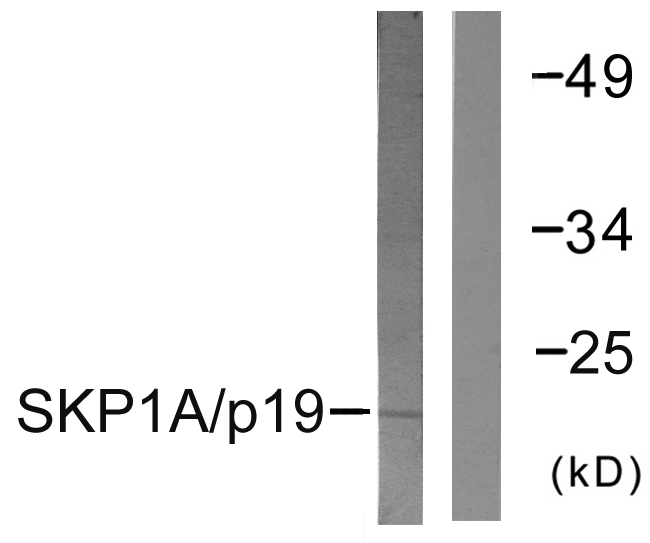SKP1 Antibody - Western blot analysis of lysates from COS7 cells, using SKP1A/p19 Antibody. The lane on the right is blocked with the synthesized peptide.