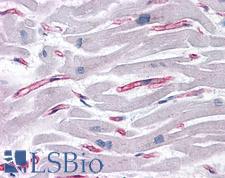 SLAIN1 Antibody - Anti-SLAIN1 antibody IHC of human heart. Immunohistochemistry of formalin-fixed, paraffin-embedded tissue after heat-induced antigen retrieval. Antibody concentration 5 ug/ml.