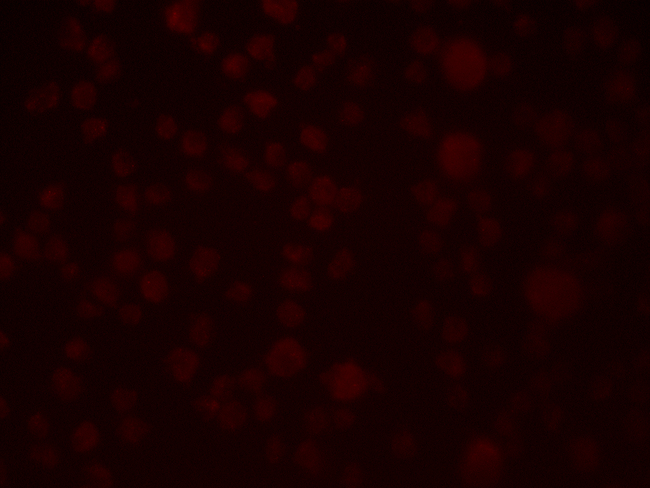 SLAIN1 Antibody - Immunofluorescence of SLAIN1 in A549 cells with SLAIN1 antibody at 2.5 µg/mL.