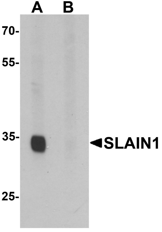 SLAIN1 Antibody - Western blot analysis of SLAIN1 in A549 cell lysate with SLAIN1 antibody at 1 ug/ml in (A) the absence and (B) the presence of blocking peptide.