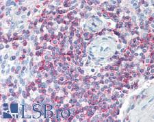 SLAMF6 / NTBA Antibody - Human Spleen: Formalin-Fixed, Paraffin-Embedded (FFPE)