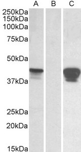 SLAMF8 Antibody - HEK293 lysate (10ug protein in RIPA buffer) overexpressing Human SLAMF8 with C-terminal MYC tag probed with (0.01ug/ml) in Lane A and probed with anti-MYC Tag (1/1000) in lane C. Mock-transfected HEK293 probed (0.01ug/ml) in Lane B. P
