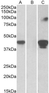 SLAMF8 Antibody - SLAMF8 antibody HEK293 lysate (10 ug protein in RIPA buffer) overexpressing Human SLAMF8 with C-terminal MYC tag probed with (1 ug/ml) in Lane A and probed with anti-MYC Tag (1/1000) in lane C. Mock-transfected HEK293 probed with (1 ug/ml) in Lane B. Primary incubations were for 1 hour. Detected by chemiluminescence.