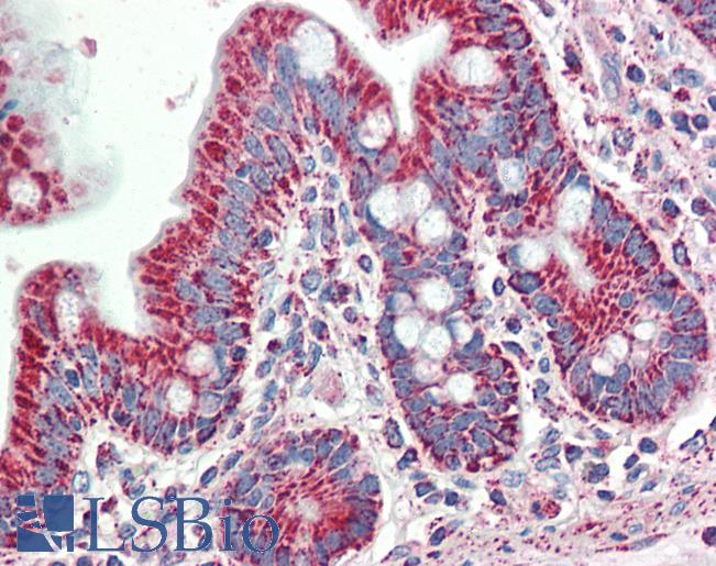 SLAMF8 Antibody - Human, Small intestine: Formalin-Fixed Paraffin-Embedded (FFPE)