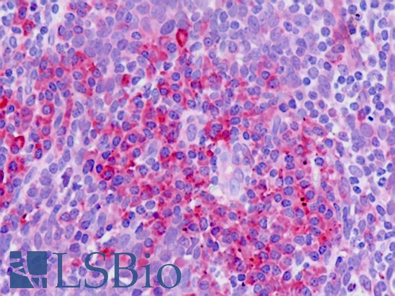 SLC11A1 / NRAMP Antibody - Anti-SLC11A1 / NRAMP antibody IHC staining of human tonsil. Immunohistochemistry of formalin-fixed, paraffin-embedded tissue after heat-induced antigen retrieval.