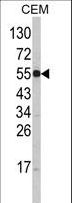 SLC11A1 / NRAMP Antibody - Western blot of SLC11A1 Antibody in CEM cell line lysates (35 ug/lane). SLC11A1 (arrow) was detected using the purified antibody.