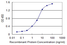 SLC11A2 / DMT1 Antibody - Detection limit for recombinant GST tagged SLC11A2 is 0.03 ng/ml as a capture antibody.