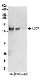 SLC12A6 / KCC3 Antibody - Detection of Human KCC3 by Western Blot. Samples: Whole cell lysate (50 ug) prepared using RIPA buffer from HeLa, 293T, and Jurkat cells. Antibodies: Affinity purified rabbit anti-KCC3 antibody used for WB at 0.1 ug/ml. Detection: Chemiluminescence with an exposure time of 3 minutes.