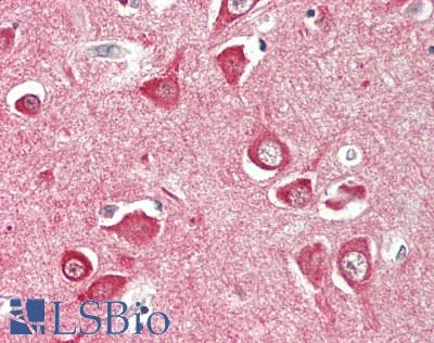 SLC12A6 / KCC3 Antibody - Human Brain, Cortex: Formalin-Fixed, Paraffin-Embedded (FFPE)
