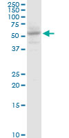 SLC13A5 Antibody - SLC13A5 monoclonal antibody, clone 2G4. Western blot of SLC13A5 expression in HepG2.