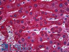 SLC13A5 Antibody - Anti-SLC13A5 antibody IHC of human liver. Immunohistochemistry of formalin-fixed, paraffin-embedded tissue after heat-induced antigen retrieval. Antibody concentration 5 ug/ml.