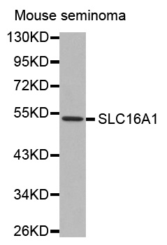 SLC16A1 / MCT1 Antibody - Western blot analysis of extracts of Mouse seminoma tissue lysate, using SLC16A1 antibody.