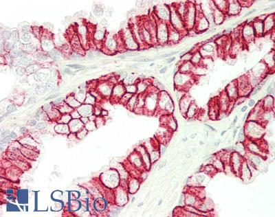 SLC16A1 / MCT1 Antibody - Human Prostate: Formalin-Fixed, Paraffin-Embedded (FFPE)