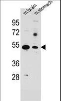 SLC16A11 Antibody - SLC16A11 Antibody western blot of mouse brain,stomach tissue lysates (35 ug/lane). The SLC16A11 antibody detected the SLC16A11 protein (arrow).