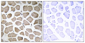 SLC16A12 / MCT12 Antibody - Anti-SLC16A12 / MCT12 antibody IHC of human skeletal muscle tissue. Immunohistochemistry of formalin-fixed, paraffin-embedded tissue. Staining on the right was blocked with peptide.