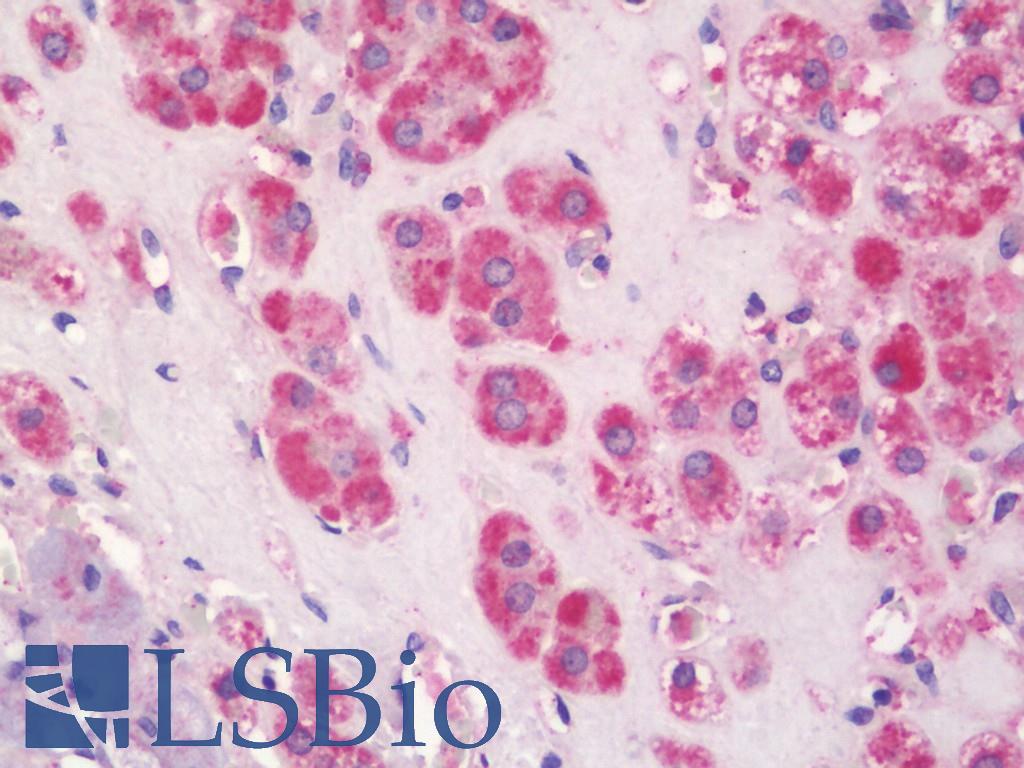 SLC16A2 / MCT8 Antibody - Anti-SLC16A2 / MCT8 antibody IHC staining of human adrenal. Immunohistochemistry of formalin-fixed, paraffin-embedded tissue after heat-induced antigen retrieval. Antibody dilution 1:200.