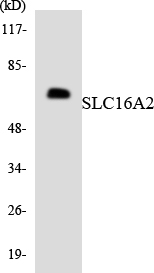 SLC16A2 / MCT8 Antibody - Western blot analysis of the lysates from HT-29 cells using SLC16A2 antibody.