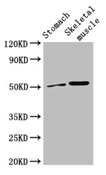 SLC16A3 Antibody - Positive WB detected in:Mouse stomach tissue,Mouse skeletal muscle tissue;All lanes:SLC16A3 antibody at 3?g/ml;Secondary;Goat polyclonal to rabbit IgG at 1/50000 dilution;Predicted band size: 50 KDa;Observed band size: 50 KDa;
