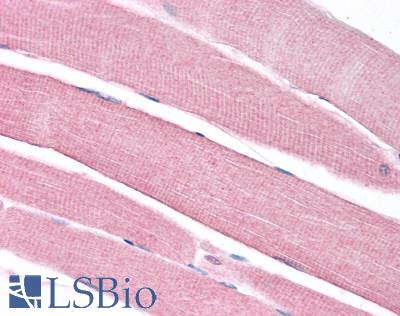 SLC16A3 Antibody - Human Skeletal Muscle: Formalin-Fixed, Paraffin-Embedded (FFPE)