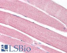 SLC16A3 Antibody - Human Skeletal Muscle: Formalin-Fixed, Paraffin-Embedded (FFPE)