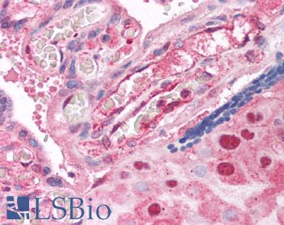 SLC16A3 Antibody - Human Placenta: Formalin-Fixed, Paraffin-Embedded (FFPE)