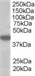 SLC16A7 / MCT2 Antibody - Antibody (1 ug/ml) staining of A549 lysate (35 ug protein in RIPA buffer). Primary incubation was 1 hour. Detected by chemiluminescence.