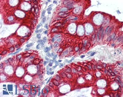 SLC16A7 / MCT2 Antibody - Human Colon: Formalin-Fixed, Paraffin-Embedded (FFPE)