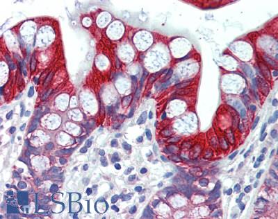 SLC16A7 / MCT2 Antibody - Human Small Intestine: Formalin-Fixed, Paraffin-Embedded (FFPE)
