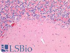 SLC17A7 / VGLUT1 Antibody - Human Brain, Cerebellum: Formalin-Fixed, Paraffin-Embedded (FFPE)