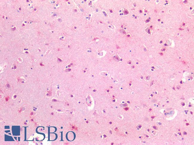 SLC17A7 / VGLUT1 Antibody - Human Brain, Cortex: Formalin-Fixed, Paraffin-Embedded (FFPE)