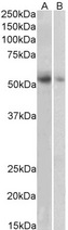 SLC18A2 / VMAT2 Antibody - SLC18A2 / VMAT2 antibody (1µg/ml) staining of Human Placenta (A) and Human Adrenal Gland (B) lysate (35µg protein in RIPA buffer). Detected by chemiluminescence.