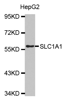 SLC1A1 / EAAT3 Antibody - Western blot analysis of extracts of HepG2 cells.