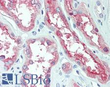 SLC1A1 / EAAT3 Antibody - Human Kidney: Formalin-Fixed, Paraffin-Embedded (FFPE)