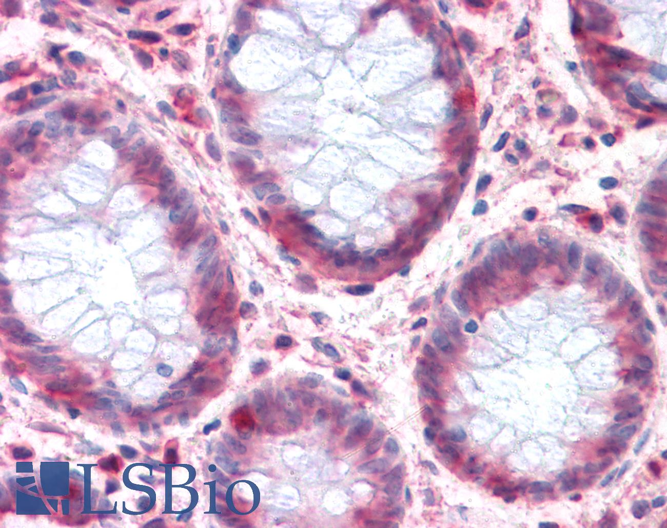 SLC1A4 / ASCT1 Antibody - Anti-SLC1A4 antibody IHC of human colon. Immunohistochemistry of formalin-fixed, paraffin-embedded tissue after heat-induced antigen retrieval.