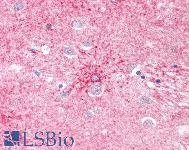 SLC1A4 / ASCT1 Antibody - Anti-SLC1A4 antibody IHC of human brain, basal ganglia. Immunohistochemistry of formalin-fixed, paraffin-embedded tissue after heat-induced antigen retrieval.