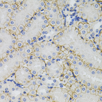 SLC1A4 / ASCT1 Antibody - Immunohistochemistry of paraffin-embedded mouse kidney tissue.