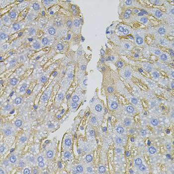 SLC1A4 / ASCT1 Antibody - Immunohistochemistry of paraffin-embedded rat liver tissue.