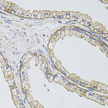 SLC1A4 / ASCT1 Antibody - Immunohistochemistry of paraffin-embedded human prostate.