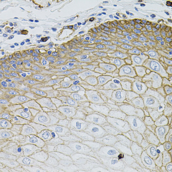 SLC1A4 / ASCT1 Antibody - Immunohistochemistry of paraffin-embedded human esophagus.
