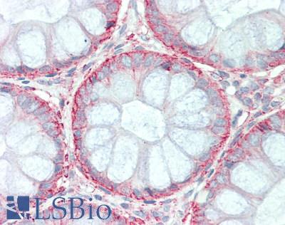 SLC1A4 / ASCT1 Antibody - Human Colon: Formalin-Fixed, Paraffin-Embedded (FFPE), at a dilution of 1:100.