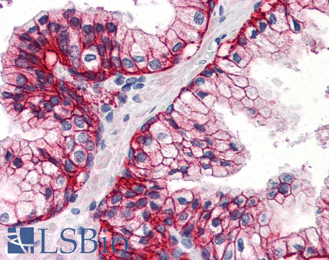 SLC1A5 / ASCT2 Antibody - Anti-SLC1A5 antibody IHC of human prostate. Immunohistochemistry of formalin-fixed, paraffin-embedded tissue after heat-induced antigen retrieval.