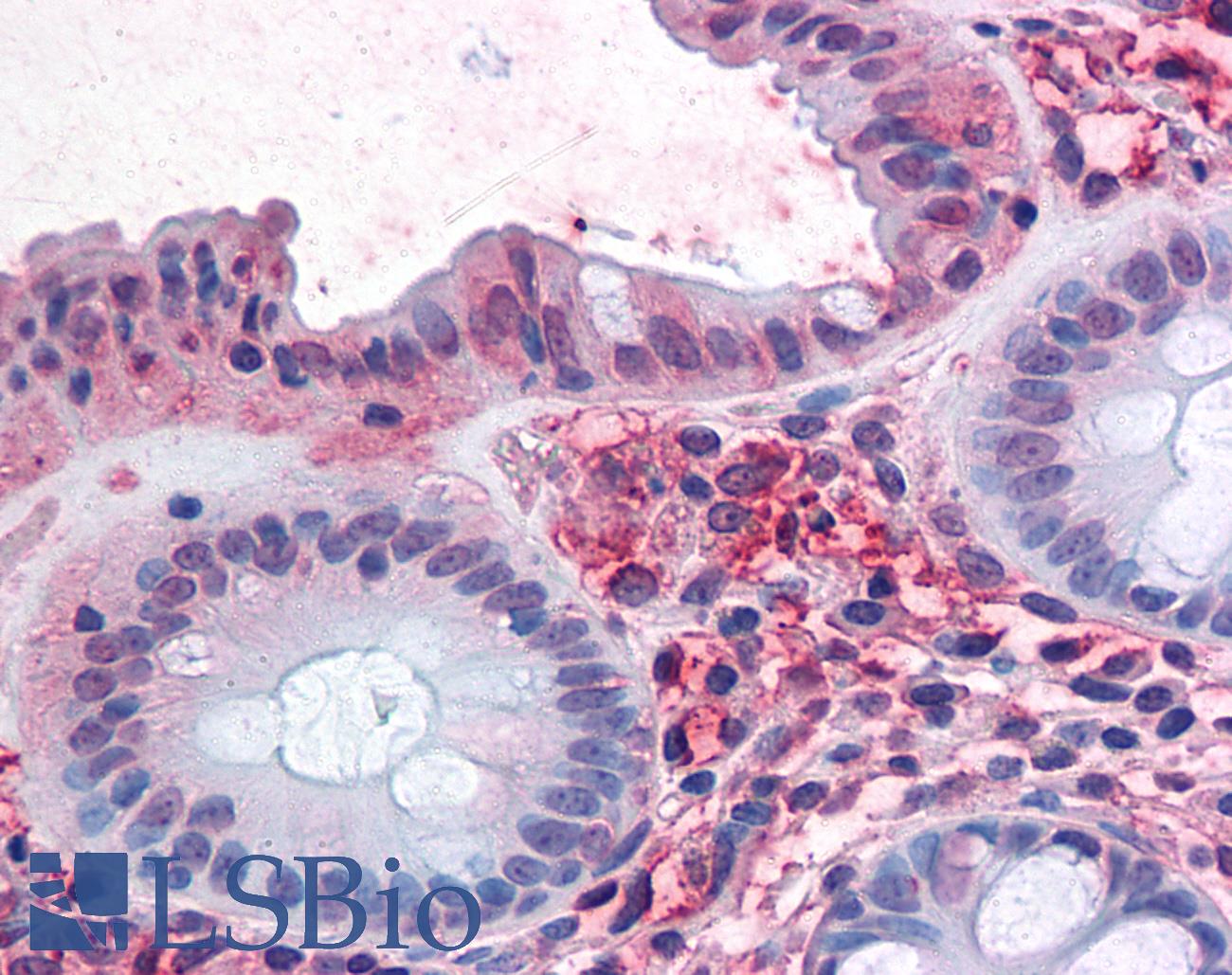 SLC1A5 / ASCT2 Antibody - Anti-SLC1A5 antibody IHC of human colon. Immunohistochemistry of formalin-fixed, paraffin-embedded tissue after heat-induced antigen retrieval.