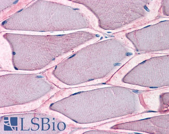 SLC1A5 / ASCT2 Antibody - Anti-SLC1A5 antibody IHC of human skeletal muscle. Immunohistochemistry of formalin-fixed, paraffin-embedded tissue after heat-induced antigen retrieval.