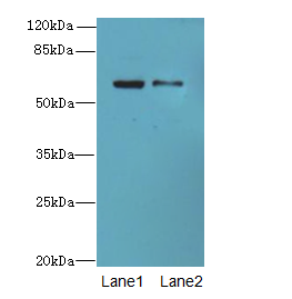 SLC1A6 / EAAT4 Antibody - Western blot. All lanes: SLC1A6 antibody at 2 ug/ml. Lane 1: Mouse kidney tissue. Lane 2: HeLa whole cell lysate. Secondary Goat polyclonal to Rabbit IgG at 1:10000 dilution. Predicted band size: 62 kDa. Observed band size: 62 kDa.