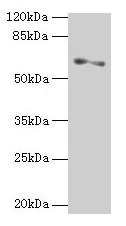 SLC1A6 / EAAT4 Antibody - Western blot All lanes: SLC1A6 antibody at 2µg/ml Lane 1: Mouse kidney tissue Lane 2: Hela whole cell lysate Secondary Goat polyclonal to rabbit IgG at 1/10000 dilution Predicted band size: 62, 35 kDa Observed band size: 62 kDa