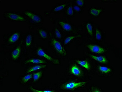 SLC1A6 / EAAT4 Antibody - Immunofluorescent analysis of Hela cells using SLC1A6 Antibody at dilution of 1:100 and Alexa Fluor 488-congugated AffiniPure Goat Anti-Rabbit IgG(H+L)